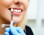 Dental Implants: How Technology is Transforming Tooth Replacement